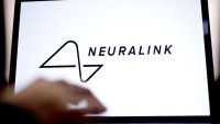 Neuralink избързва с тестовете покрай човешки трансплантации