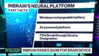 Inbrain набра $50 млн финансиране за мозъчна сонда, част 1